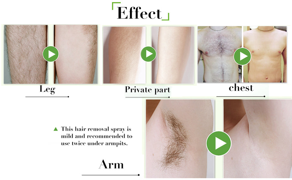 Hair Removal Spray