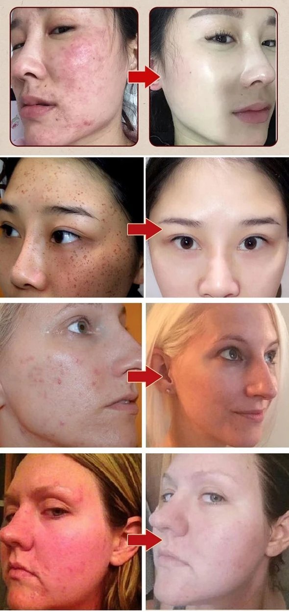 Pro-Herbal Refining Peel-Off Facial