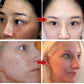 Pro-Herbal Refining Peel-Off Facial